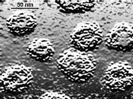 EM of pap virus, 2C basal tissue grafted to mouse.jpg