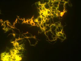 Окраска флуоресцентными красителями культуры M.tuberculosis с жидкой среды(корд - фактор)