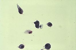 Trichomonas vaginalis 01.jpg