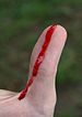 Bleeding wound on thumb.jpg