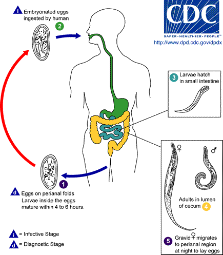 A pinworms emberről emberre terjed A pinworm képe