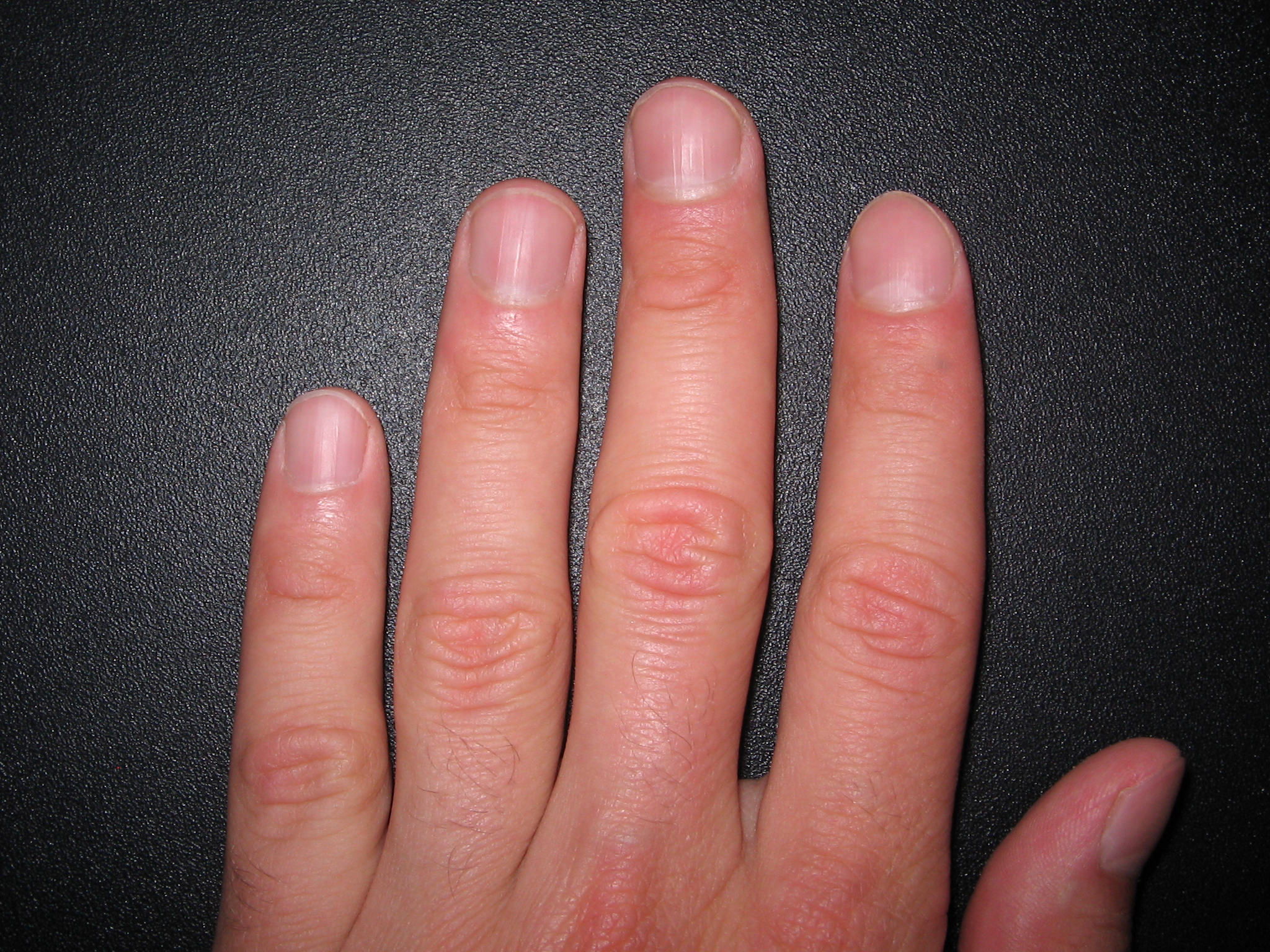 Кончиками пальчиками. Нормальный цвет ногтей на руках.