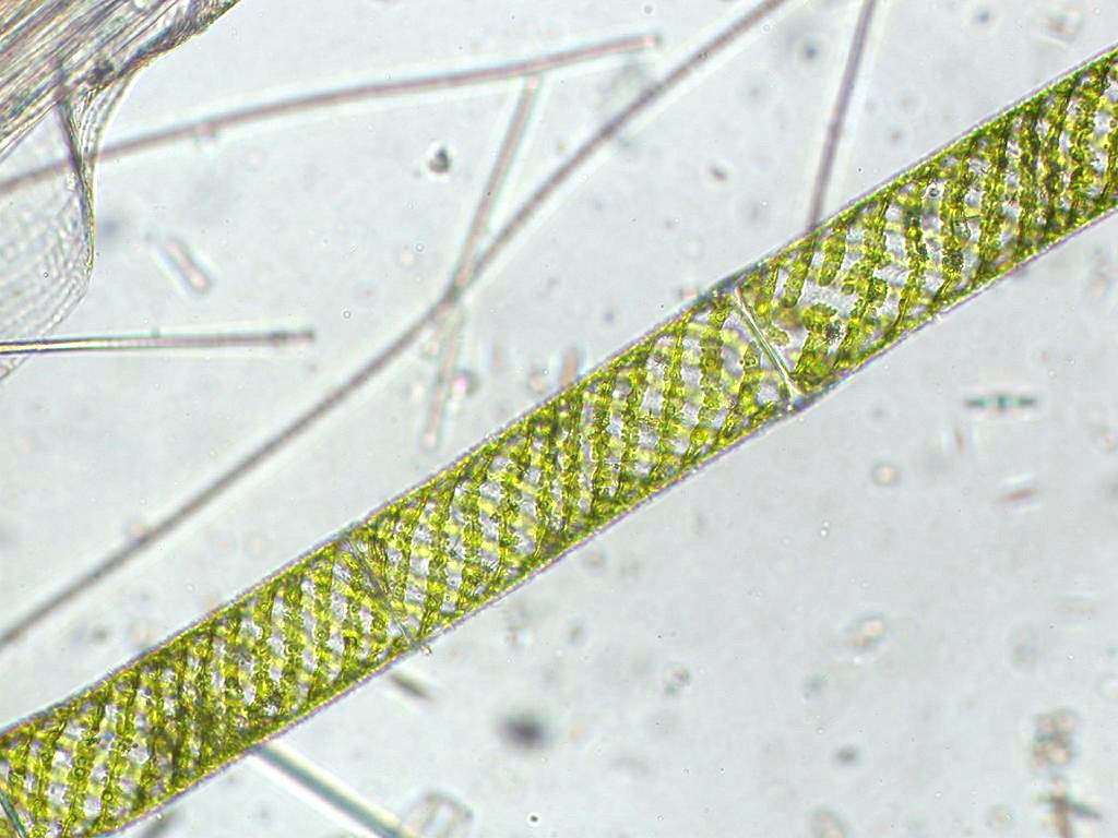 Спирогира имеет. Спирогира водоросль. Нитчатая водоросль спирогира. Спирогира в микроскопе. Многоклеточная нитчатая зелёная водоросль спирогира.